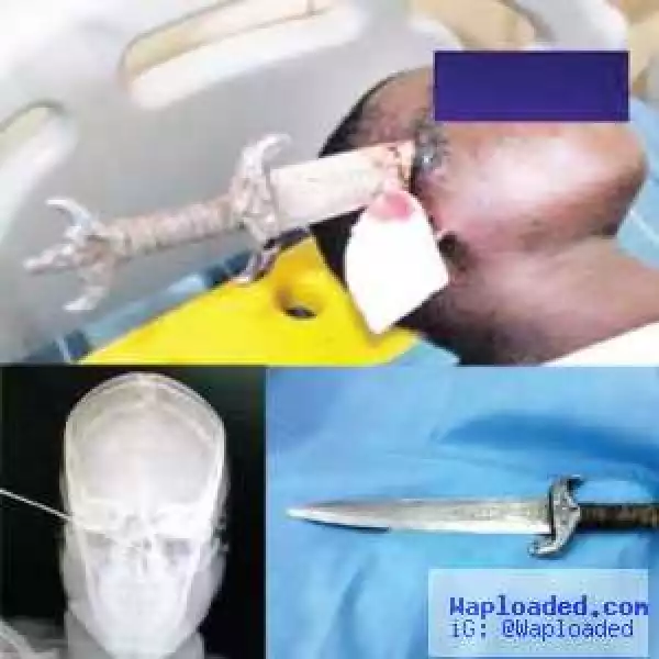 wicked world!! Robber Drives Dagger Into Man’s Head In Abuja (See Graphics Photo)